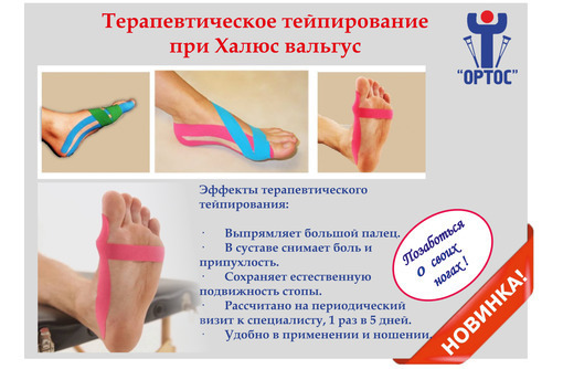 Тейпирование при вальгусной деформации большого пальца стопы - Медицинские услуги в Севастополе