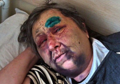 В Севастополе вновь открыто уголовное дело об избиении пожилой женщины