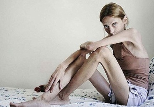 Больных анорексией в Крыму стало больше