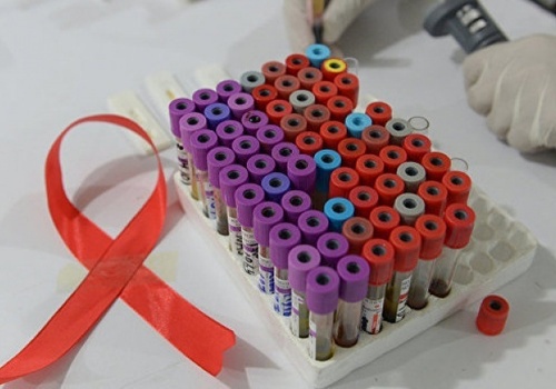 В Крыму 15 тысяч человек заражены ВИЧ