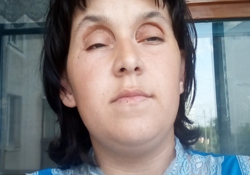 Почти незрячей матери-одиночке отказали в инвалидности в Крыму, после уволили с работы из-за плохого зрения