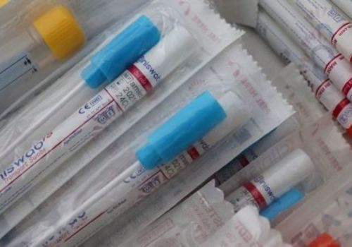 За сутки в Крыму выявили 152 новых случая коронавируса