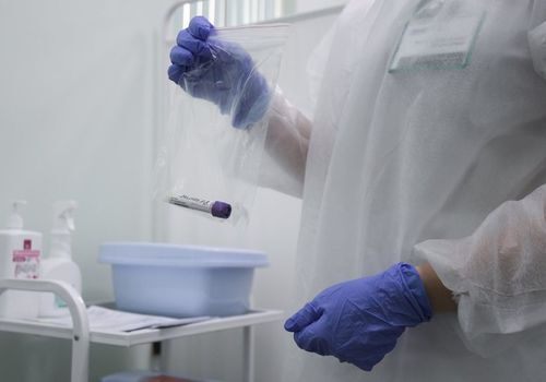 72 случая коронавируса выявили в Крыму за сутки