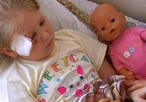 Севастопольской малышке, покалеченной упавшей веткой, нужна пластическая операция (фото)